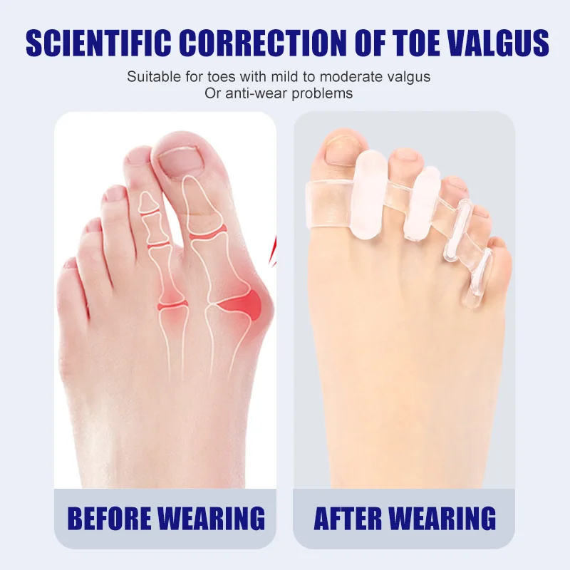 1 Pair Silicone Toe Separator  – Toe Separator Silicon recenzja i cena