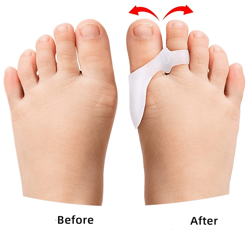 1/2/3Pairs Children's Gel Toe  – Toe Separator Silicon recenzja i cena