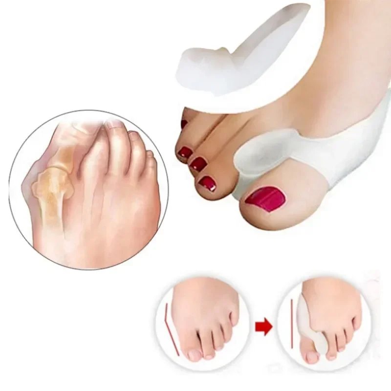 2PCS Silicone Gel Thumb Correc – Toe Separator Silicon recenzja i cena