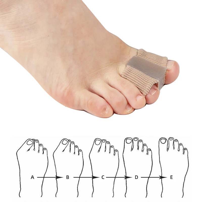 Gel Bunion Toe Separators W/Fa – Toe Separator Silicon recenzja i cena