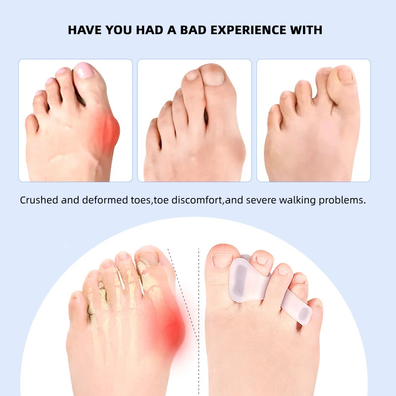 1/2/5Pairs Hallux Valgus Appli – Toe Separator Silicon recenzja i cena